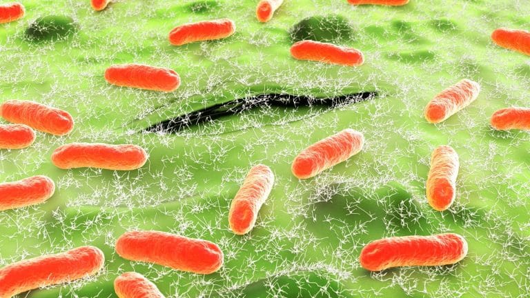 Deux enfants décèdent à cause de E-Coli Deux enfants décèdent à cause de E-Coli